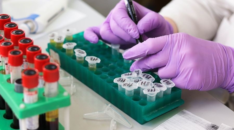 В более чем 50 странах мира растет число случаев заболевания ковидом