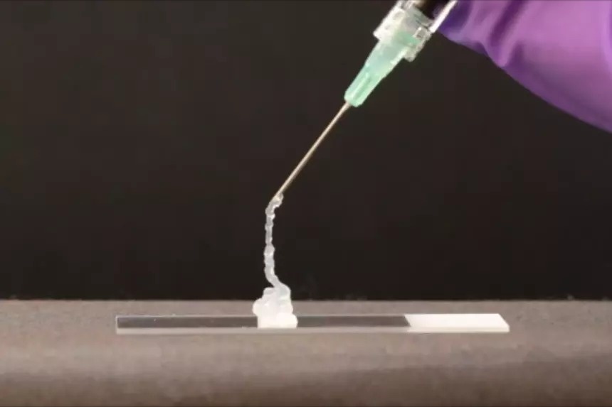 Ученые разработали инновационный гель для лечения рака