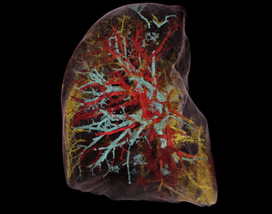 Медицинские изображения революционно увеличили разрешение: органы можно рассмотреть с детализацией в микрон