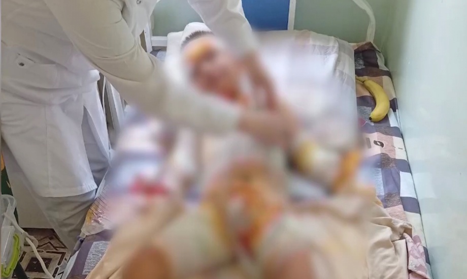 В детском саде в Фергане 6-летнего ребенка ударило током высокого напряжения