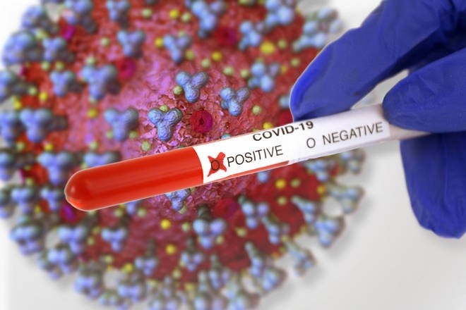 Эксперты описали признаки коронавируса у бессимптомников