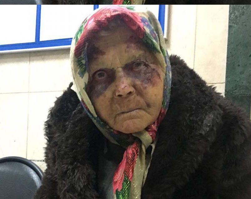 Ўзбекистоннинг Москвадаги элчихонаси калтакланган ўзбекистонлик фуқарога ёрдам бермоқда