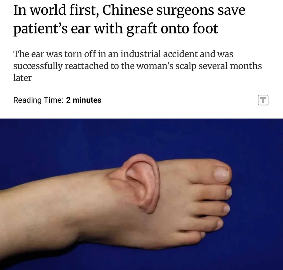 Хитойда жарроҳлар ноодатий амалиётга қўл уришди