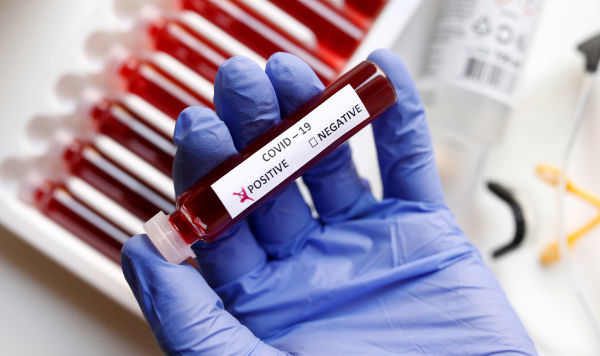 В Навоийской области выявлено 16 новых случаев заражения коронавирусом