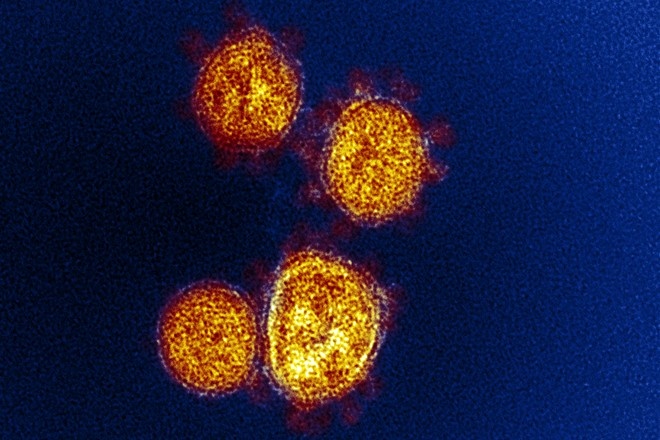 Инфекционист объяснил случай, когда COVID-19 почти год «жил» в пациентке