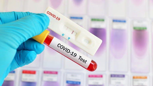 Uxanning 11 million aholisi koronavirusga test topshiradi