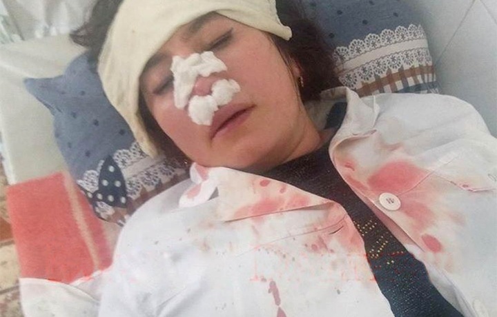УВД Ферганы прокомментировало избиение медсестры в поликлинике